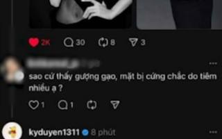 Kỳ Duyên đáp trả sau khi bị chê mặt cứng đờ như phẫu thuật thẩm mỹ